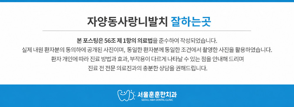 자양동사랑니발치 잘하는곳 신경 가까운 매복 사랑니 확인 기준과 주의사항 필수