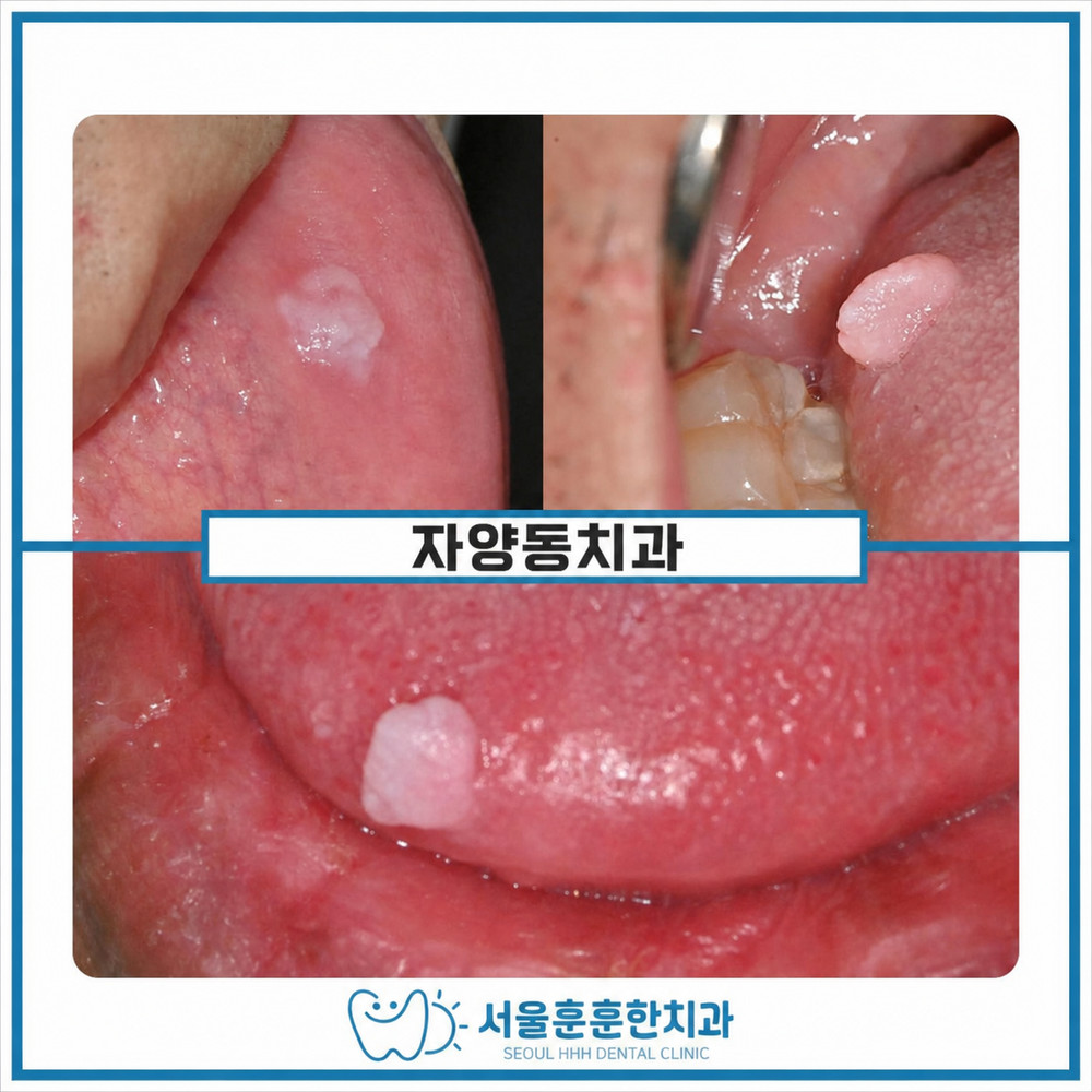 자양동치과 서울훈훈한치과 대학병원 방문 없는 구강 조직검사 의뢰 안내