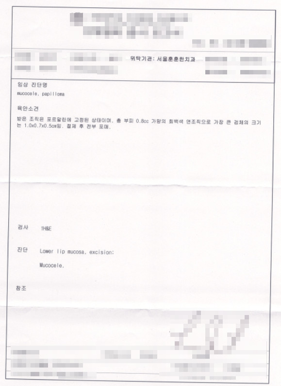 자양동치과 조직 채취 부위 섬세한 봉합과 잘 아물었는지 추후 확인 체크 과정