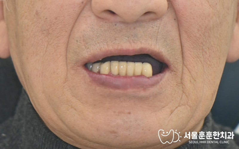 광진구치과추천