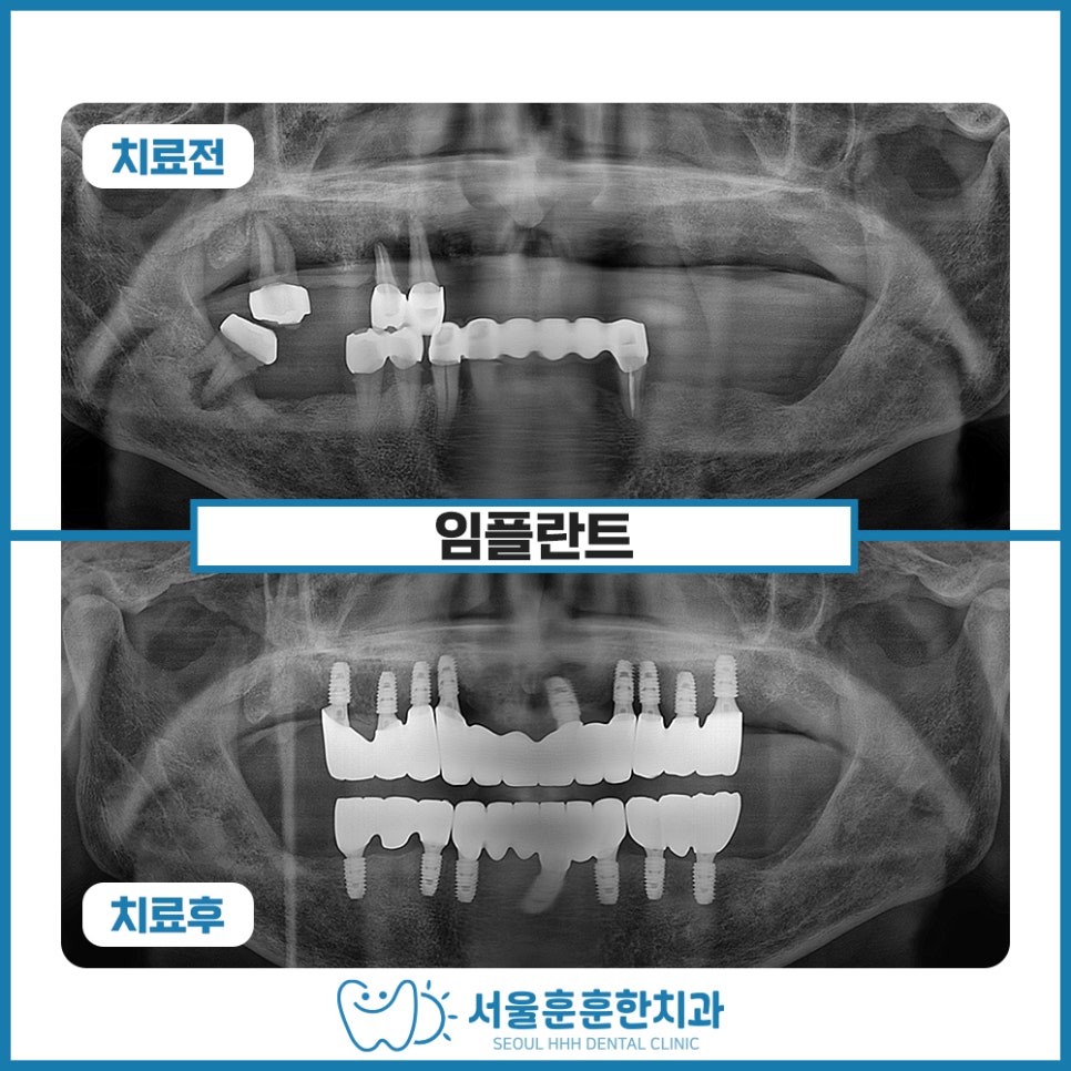 광진구치과치료
