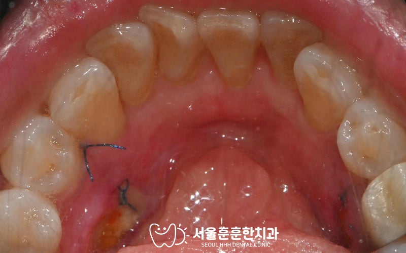 광진구구강외과