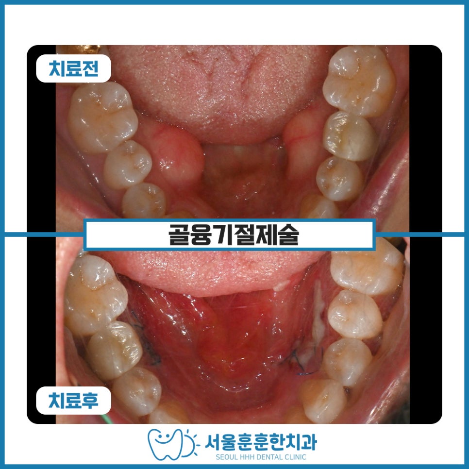 자양동수면치과잘하는곳
