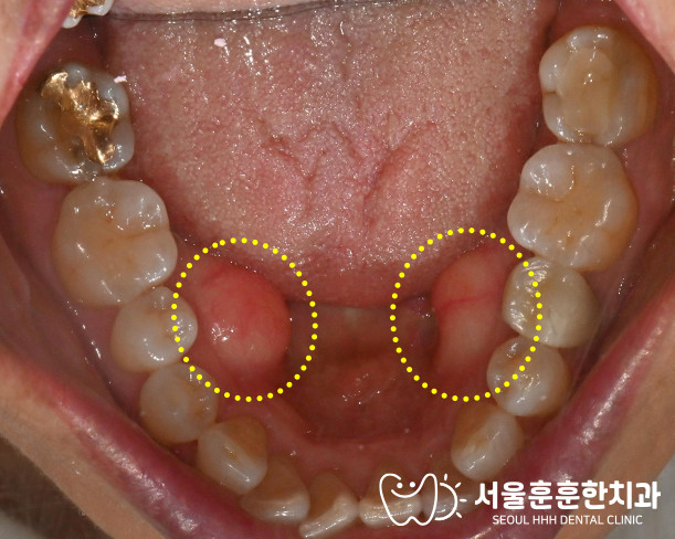 광진구치과추천