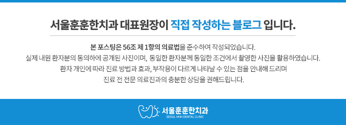 자양동치과브릿지충치치료방법