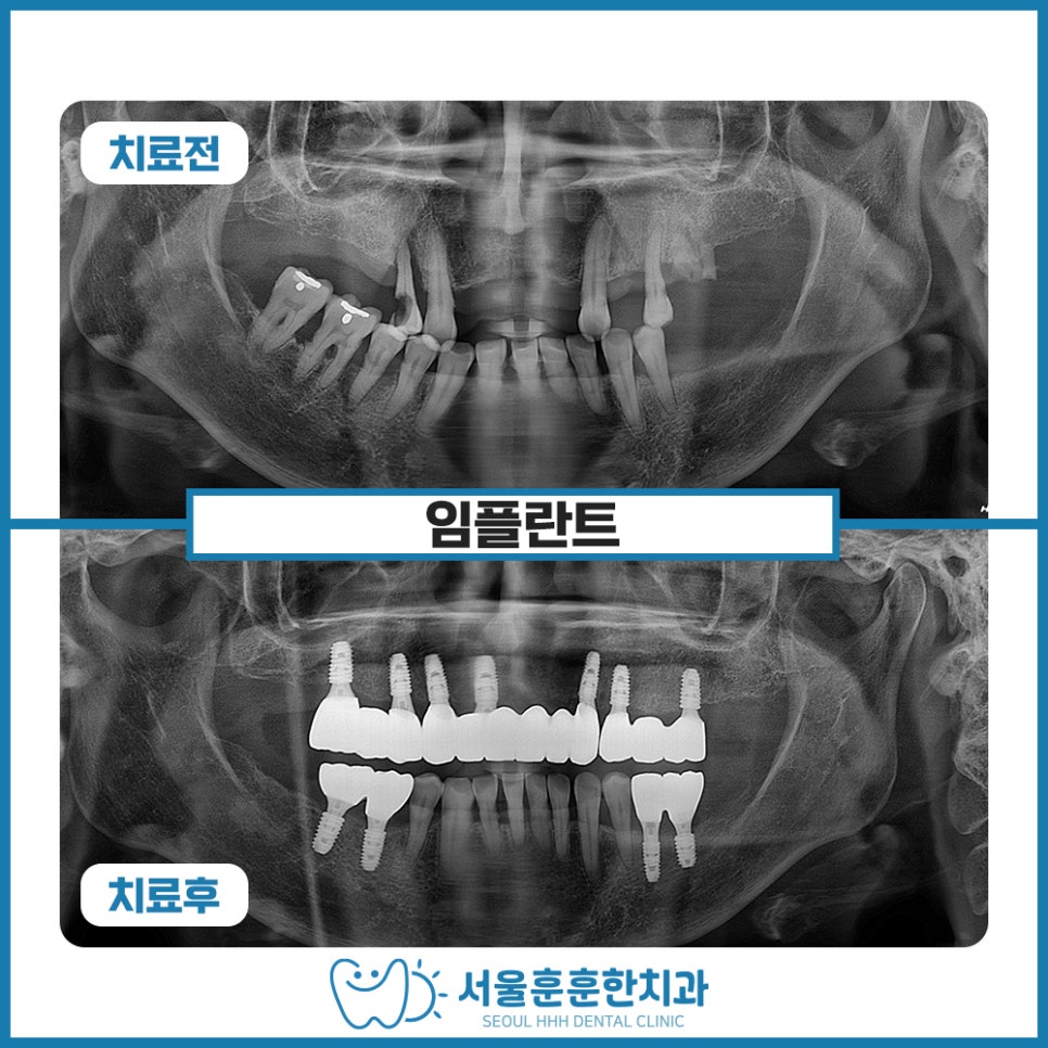 광진구수면치과수면치료