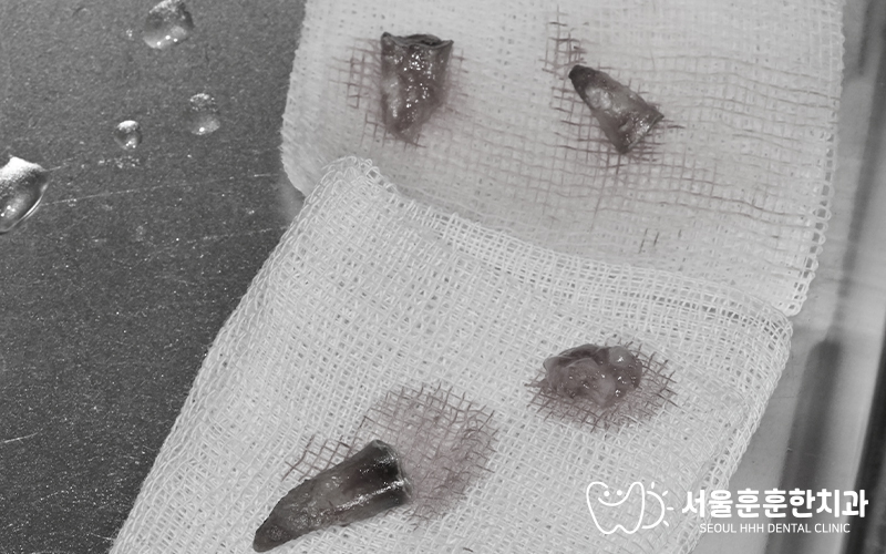 광진구치과기능회복
